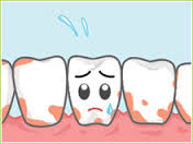 花粉症が歯周病の原因になる 愛知県江南市すぎもと歯科 一宮市 犬山市 各務原市からも近い歯医者