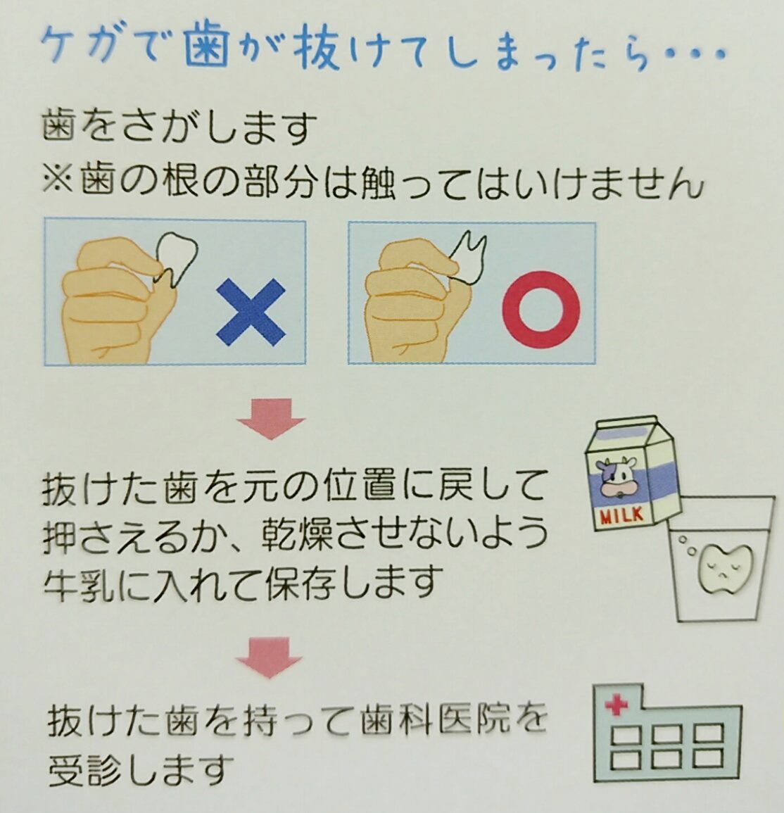 ぶつけて歯が抜けた どうする 愛知県江南市すぎもと歯科 一宮市 犬山市 各務原市からも近い歯医者