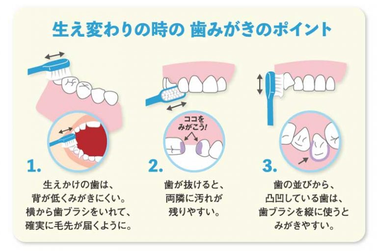 仕上げ磨きはいつまで必要？ 愛知県江南市すぎもと歯科 一宮市 犬山市 各務原市からも近い歯医者