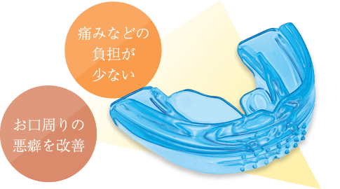 お口周りの悪癖を改善、痛みなどの負担が少ない　マウスピースの画像